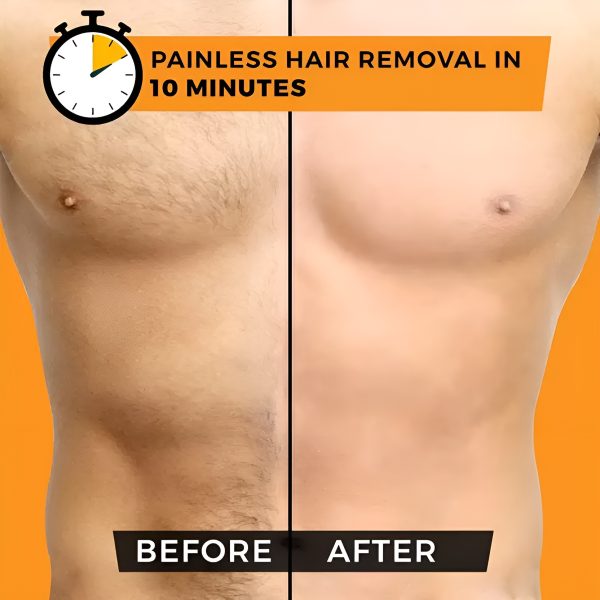 Chirs’s Men Hair Removal Spray Full Body Hair Removal Spray | Best Hair Removal Spray – 180ml